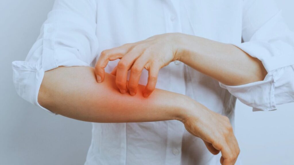 薬剤師 運営 健康情報サイト 紫外線